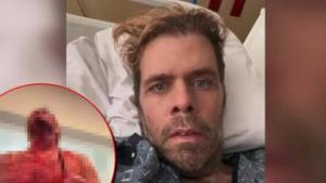 Pérez Hilton clama por ayuda después de autolesionarse en vivo